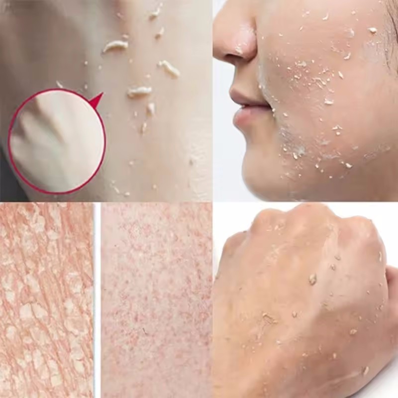 Pomarańczowy złuszczający żel  – Ceramide Moisturizer recenzja i cena