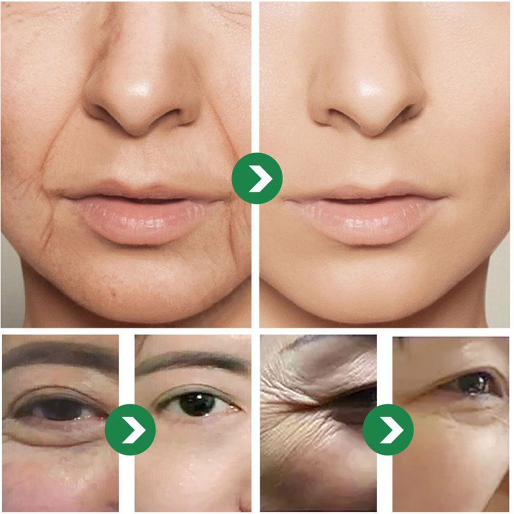 50g Japoński Krem z Sześcioma  – Eye Cream Peptide recenzja i cena